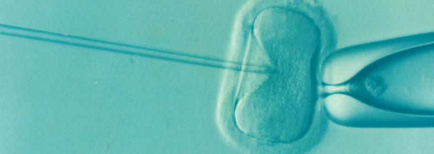 Procedimento procreazione medicalmente assistita fecondazione in vitro